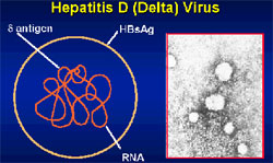 Гепатит D